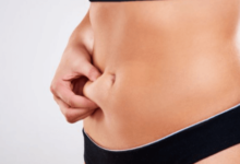 Tummy Tuck