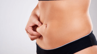 Tummy Tuck