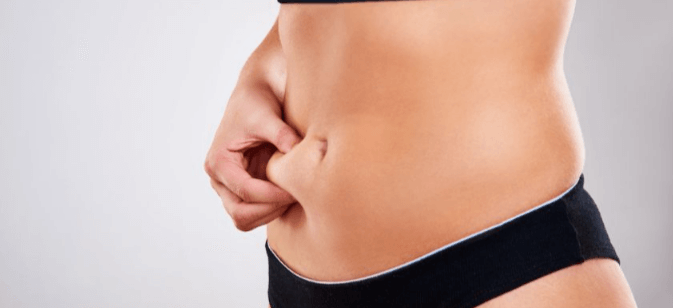 Tummy Tuck